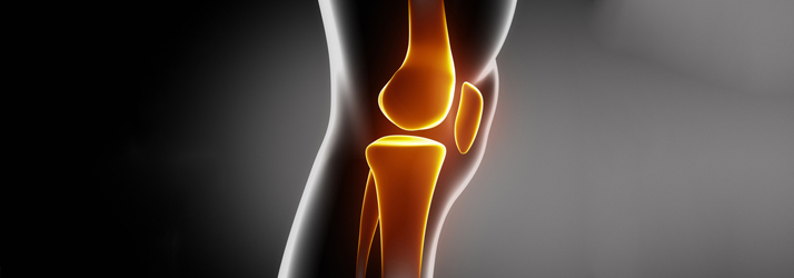 Chiropractic Columbia MO Bone-On-Bone Knee Pain